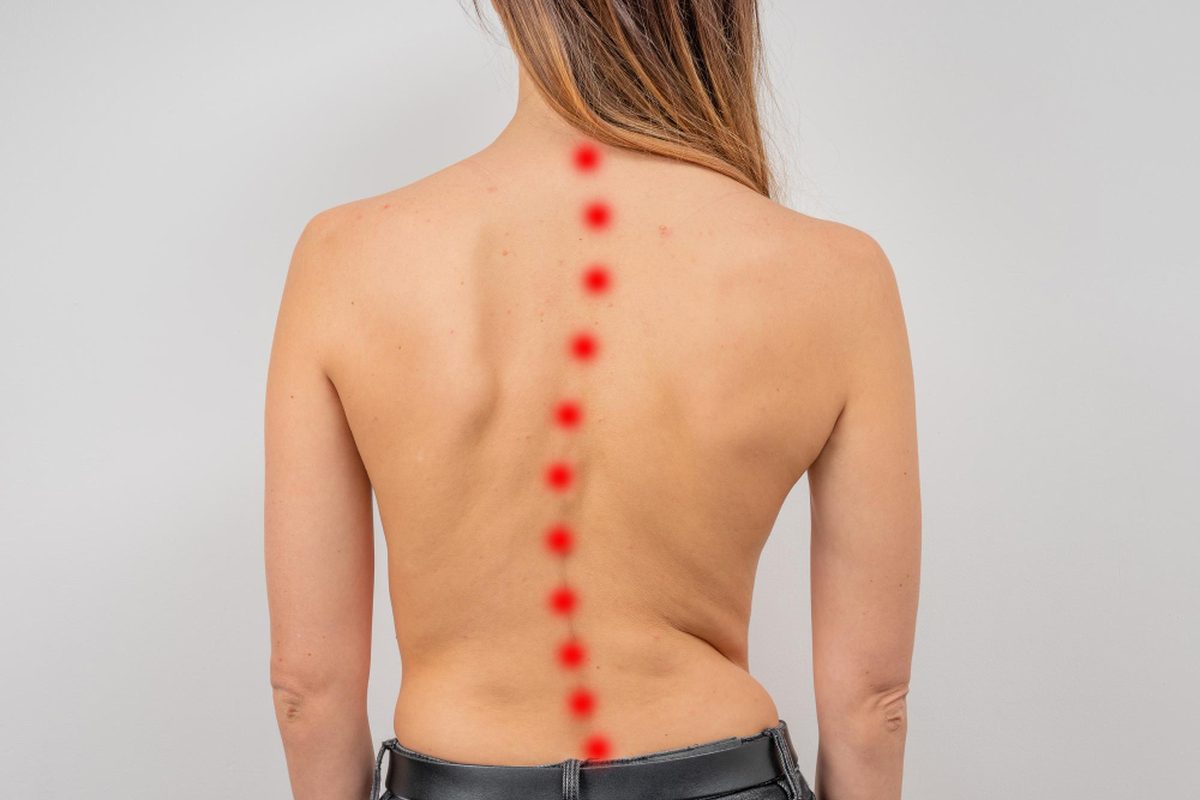 Spinal deformity
