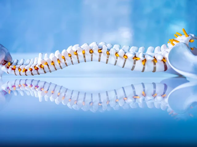 What Causes Adult Scoliosis?
