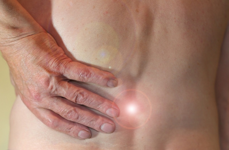 What Is Lumbar Fusion?