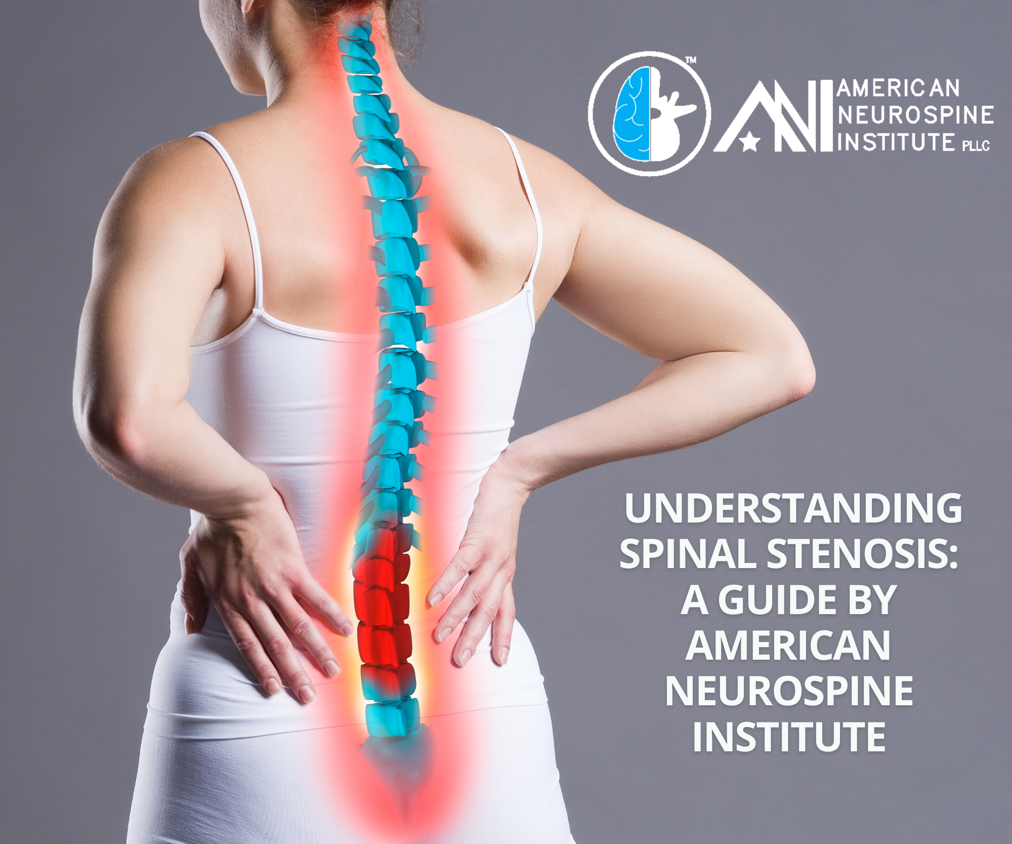 Understanding Spinal Stenosis: A Guide by American Neurospine Institute Institute